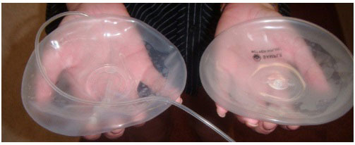saline breast implants